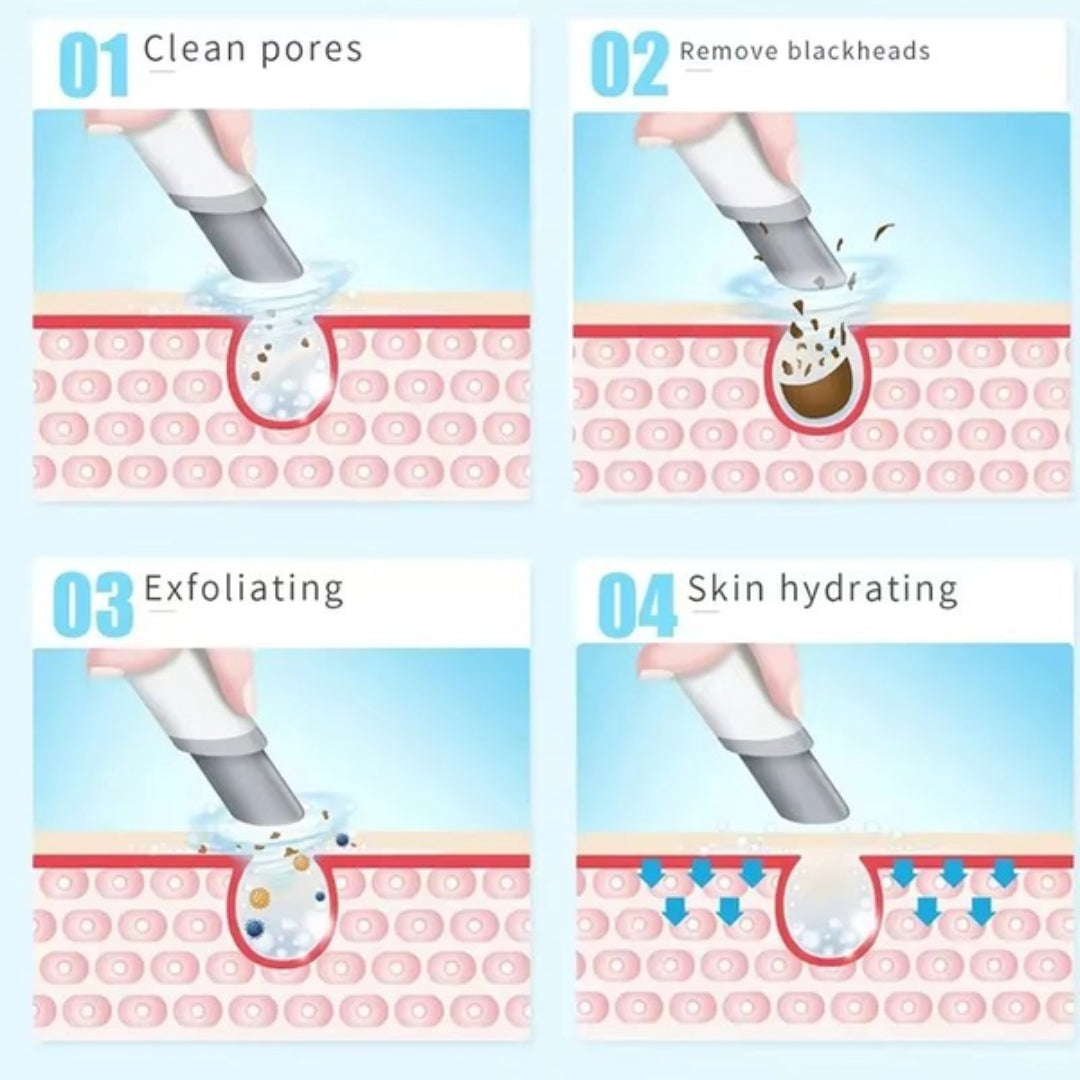 HydraGlow™ Deep Pore Cleansing Facial Device