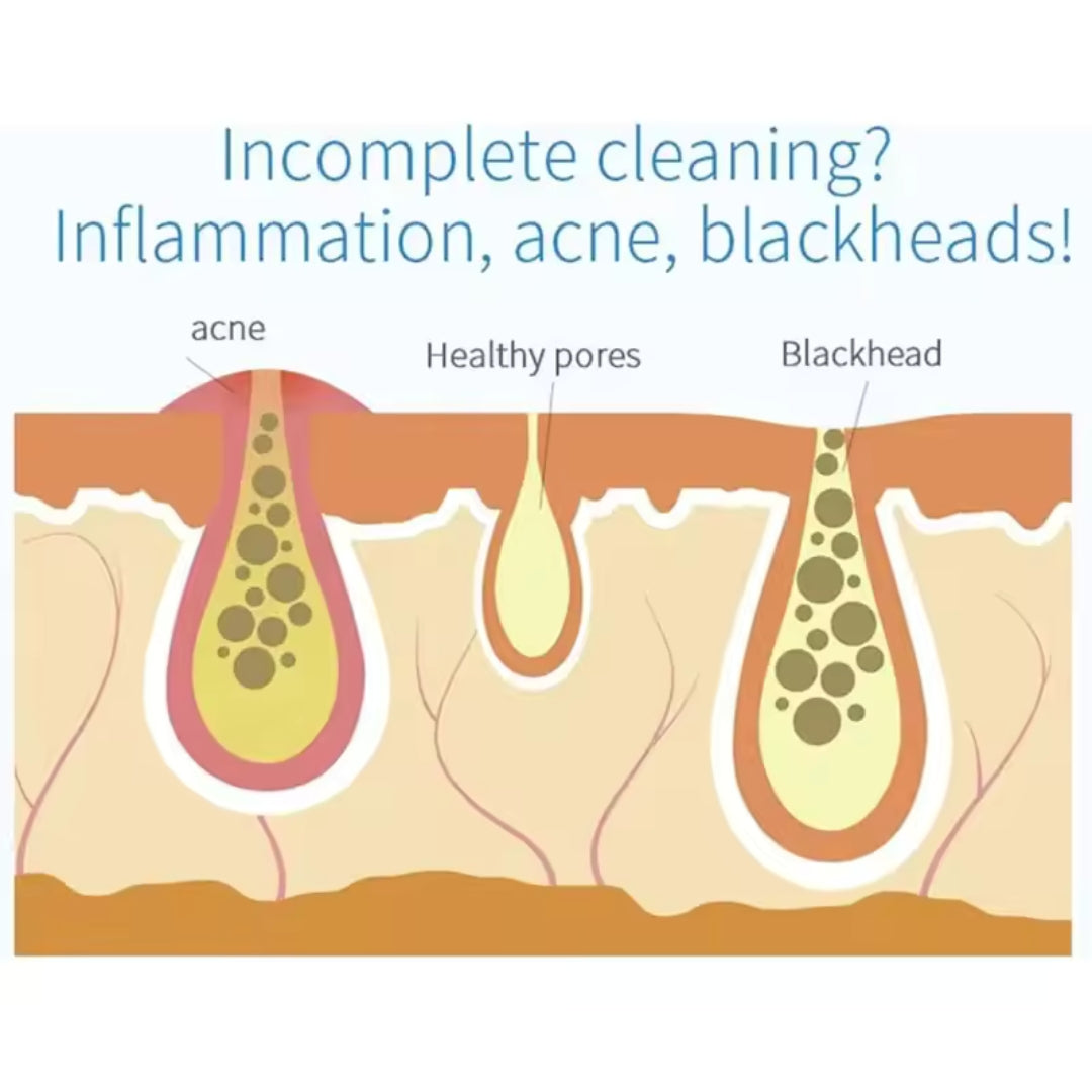 HydraGlow™ Deep Pore Cleansing Facial Device