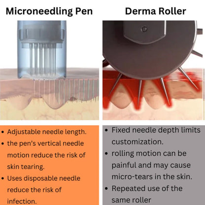 DermaGlow™ Microneedling Skin Renewal Pen
