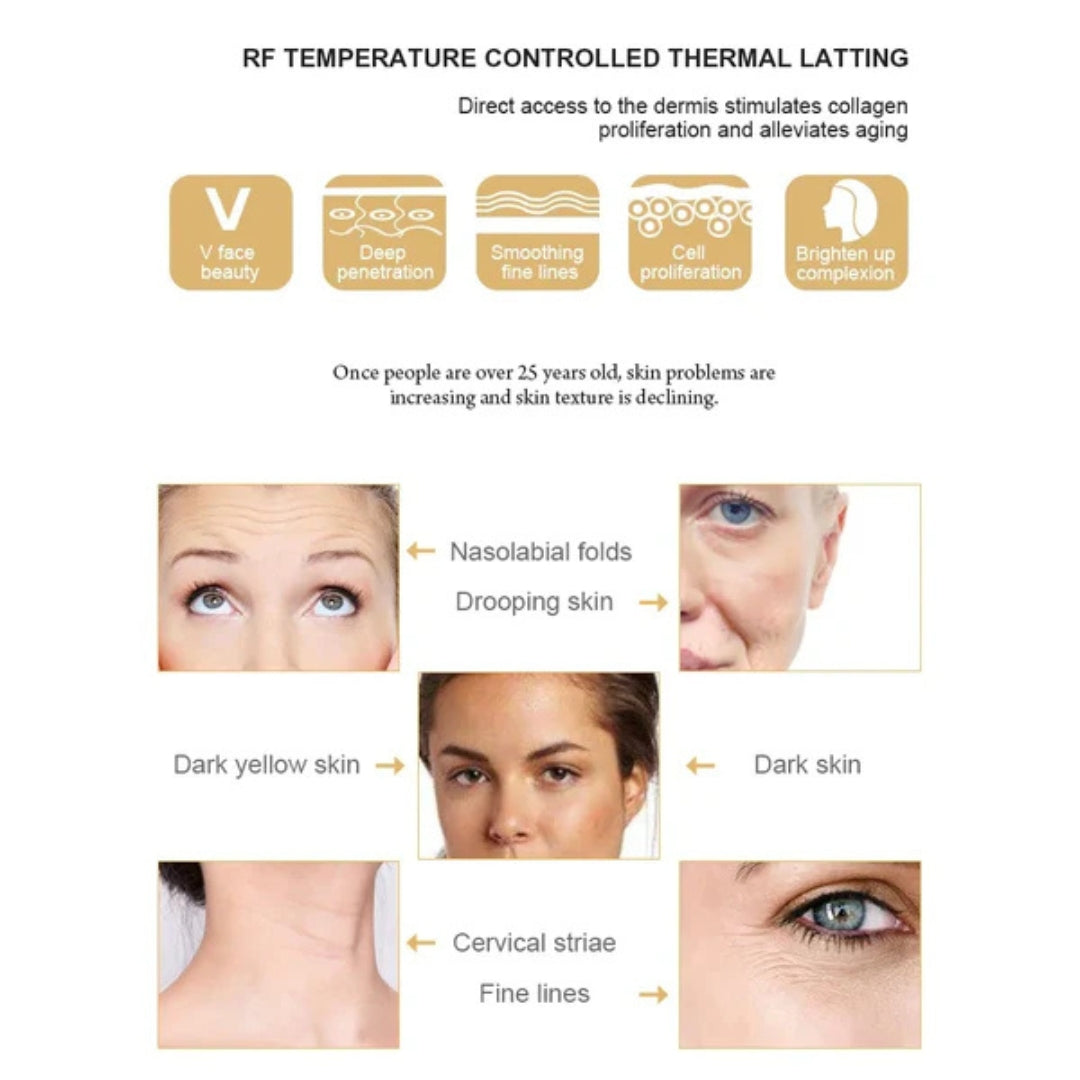 ThermaLift™ RF Skin Rejuvenation Device