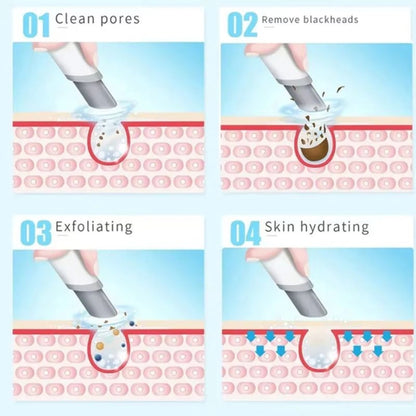 HydraGlow™ Deep Pore Cleansing Facial Device