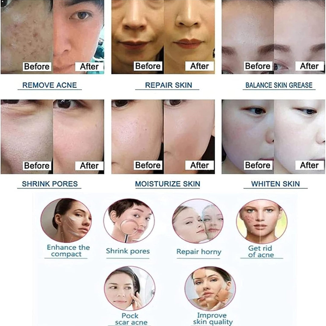 HydraGlow™ Deep Pore Cleansing Facial Device