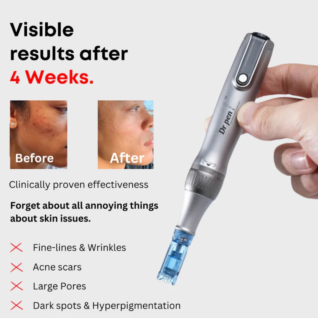 DermaGlow™ Microneedling Skin Renewal Pen
